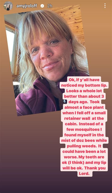 LPBW star Amy Roloff suffers minor accident while on。